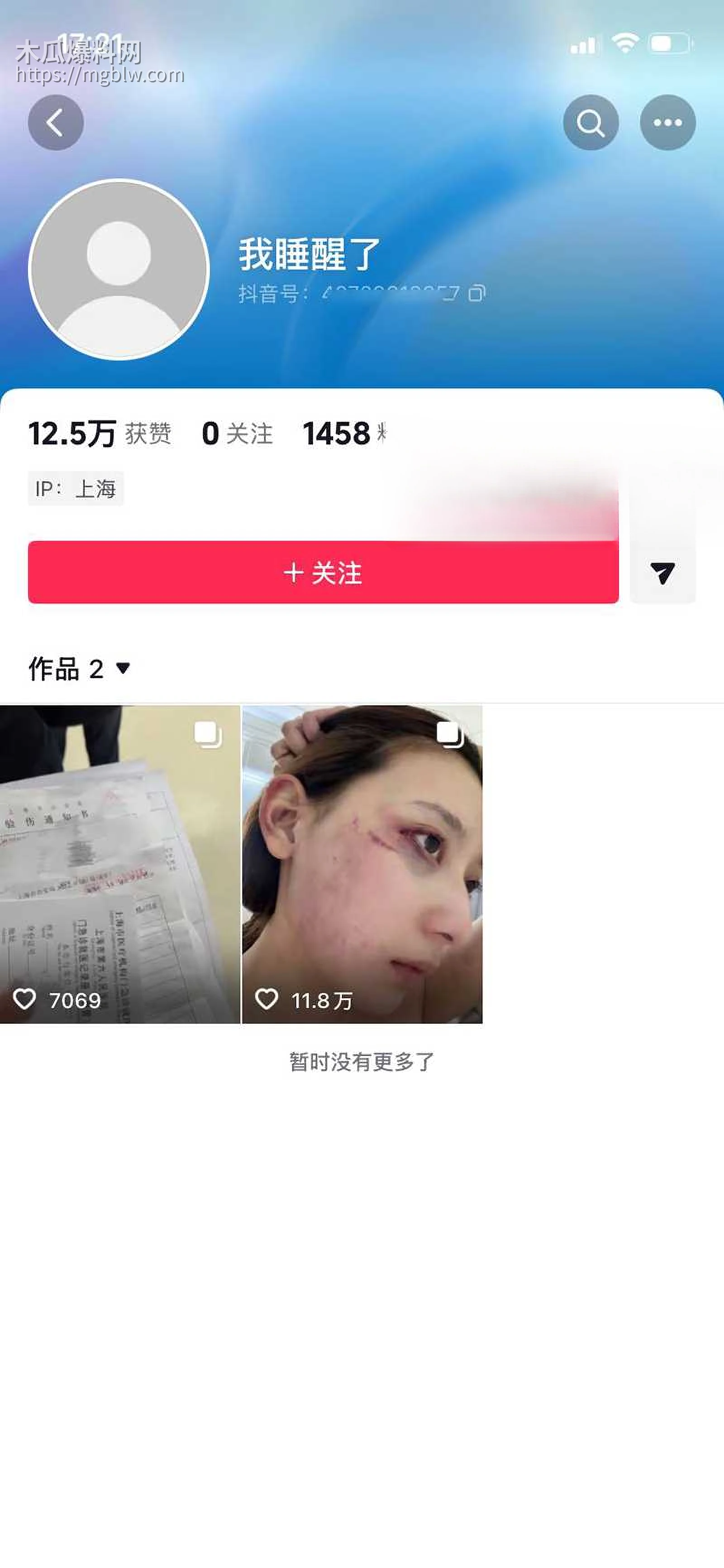 千万大V张百乔家暴视频被扒 1 拷贝
