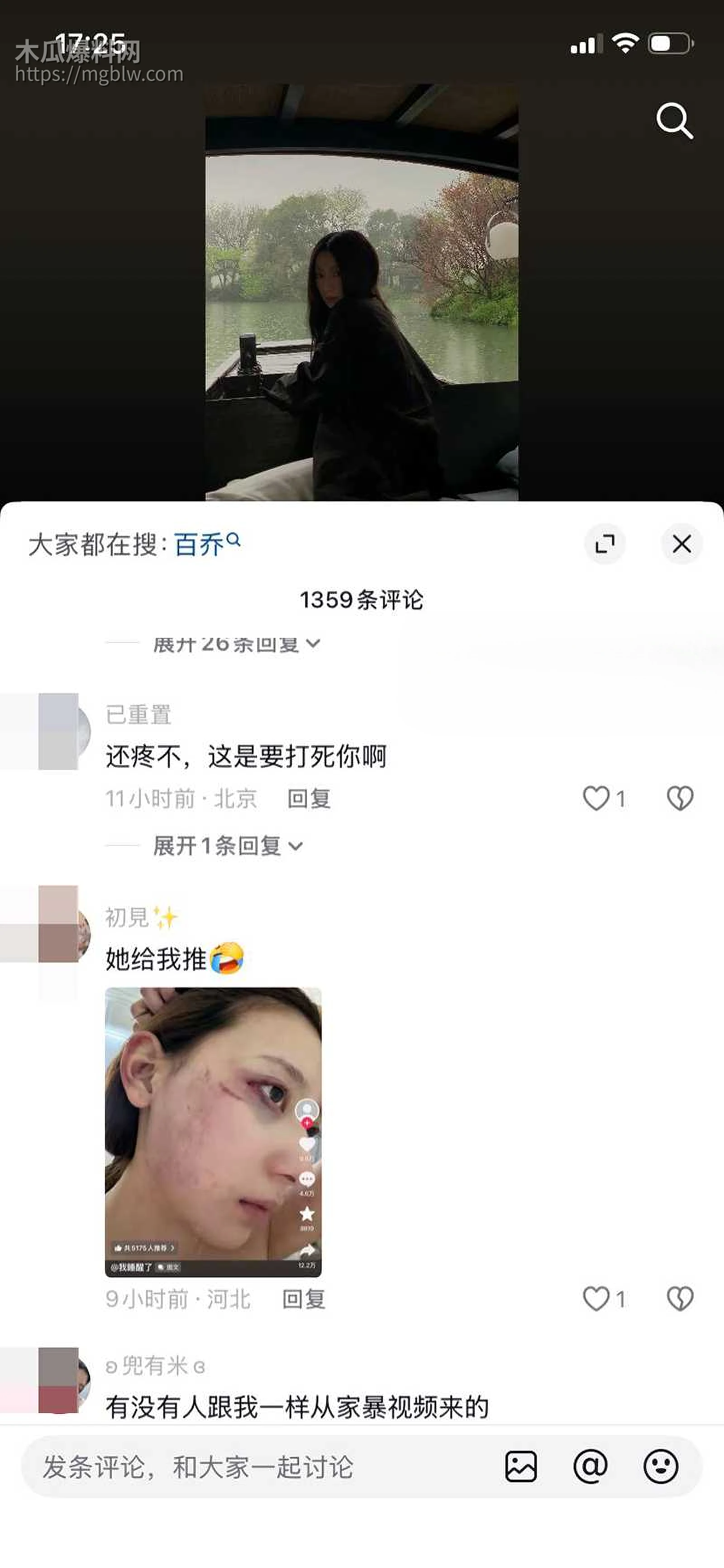 千万大V张百乔家暴视频被扒 20 拷贝