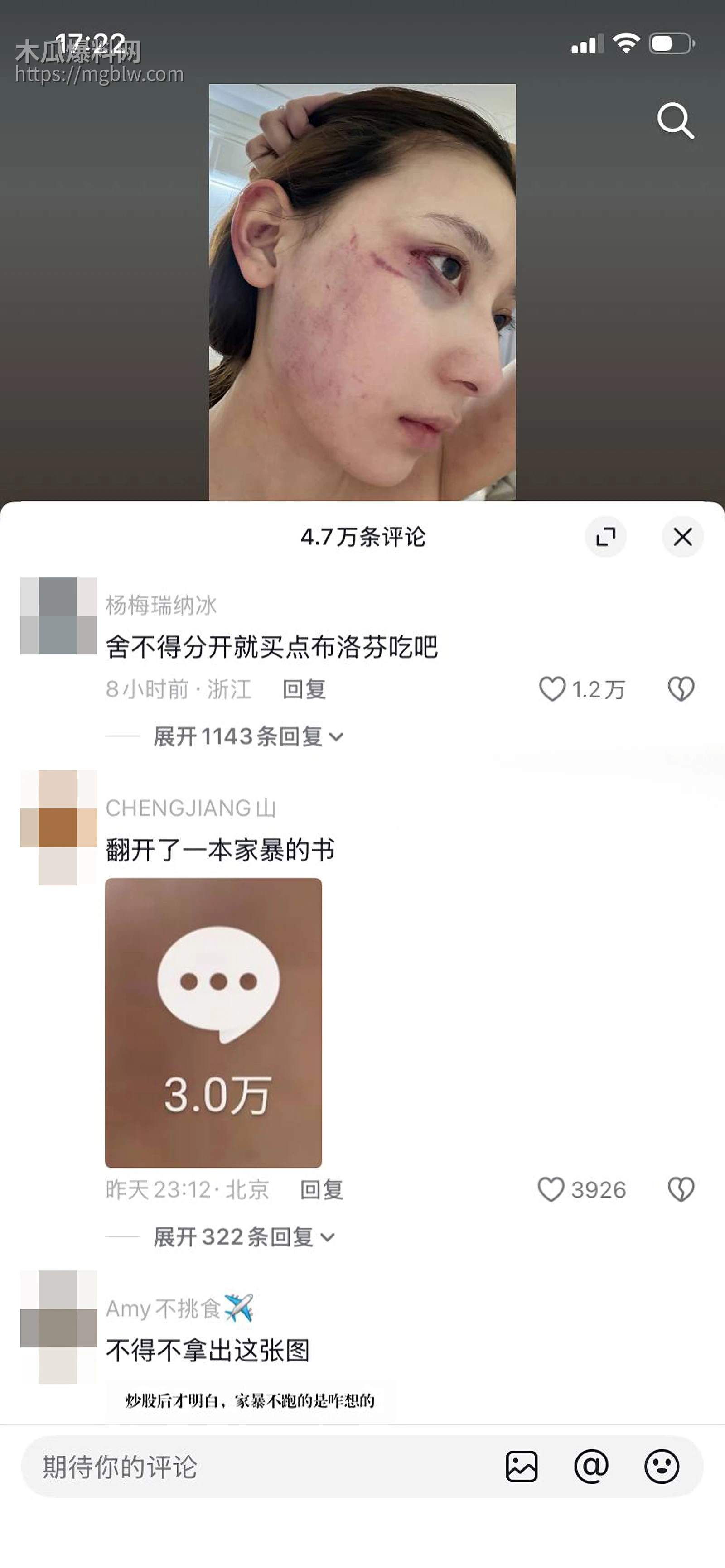 千万大V张百乔家暴视频被扒 21 拷贝