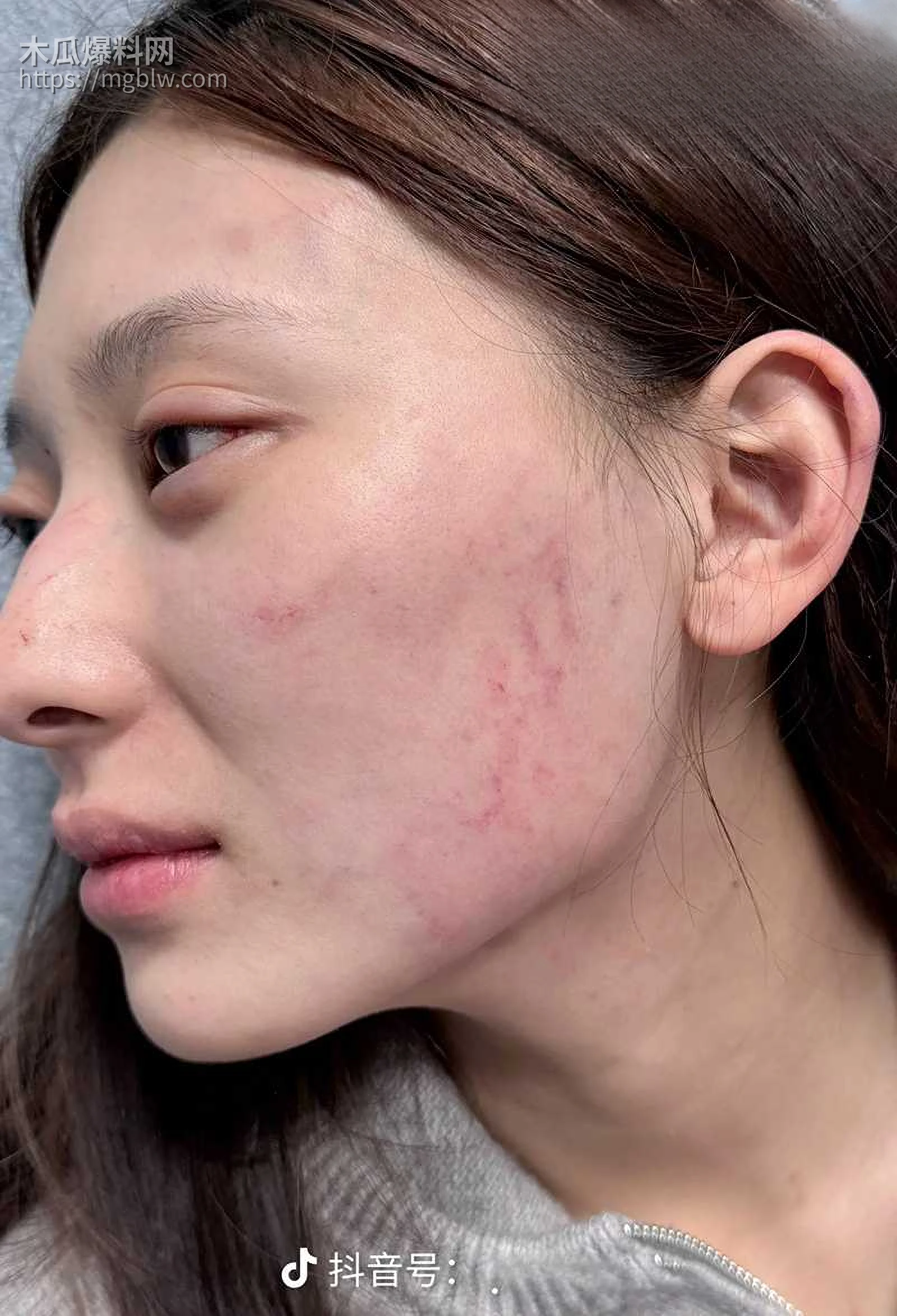 千万大V张百乔家暴视频被扒 31 拷贝